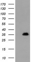 SULT1A1 / Sulfotransferase 1A1 Antibody - HEK293T cells were transfected with the pCMV6-ENTRY control (Left lane) or pCMV6-ENTRY SULT1A1 (Right lane) cDNA for 48 hrs and lysed. Equivalent amounts of cell lysates (5 ug per lane) were separated by SDS-PAGE and immunoblotted with anti-SULT1A1.