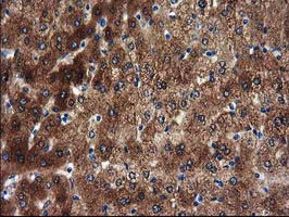 SULT1A1 / Sulfotransferase 1A1 Antibody - IHC of paraffin-embedded Human liver tissue using anti-SULT1A1 mouse monoclonal antibody.