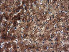 SULT1A1 / Sulfotransferase 1A1 Antibody - IHC of paraffin-embedded Human liver tissue using anti-SULT1A1 mouse monoclonal antibody.