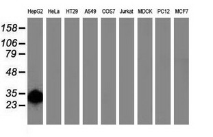 SULT1A1 / Sulfotransferase 1A1 Antibody - Western blot of extracts (35 ug) from 9 different cell lines by using anti-SULT1A1 monoclonal antibody (HepG2: human; HeLa: human; SVT2: mouse; A549: human; COS7: monkey; Jurkat: human; MDCK: canine; PC12: rat; MCF7: human).