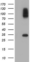 SULT1A1 / Sulfotransferase 1A1 Antibody - HEK293T cells were transfected with the pCMV6-ENTRY control (Left lane) or pCMV6-ENTRY SULT1A1 (Right lane) cDNA for 48 hrs and lysed. Equivalent amounts of cell lysates (5 ug per lane) were separated by SDS-PAGE and immunoblotted with anti-SULT1A1.