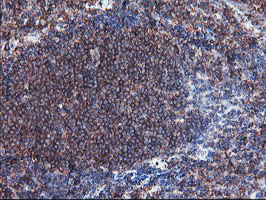 SULT1A1 / Sulfotransferase 1A1 Antibody - IHC of paraffin-embedded Human tonsil using anti-SULT1A1 mouse monoclonal antibody.