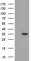 SULT1A1 / Sulfotransferase 1A1 Antibody - HEK293T cells were transfected with the pCMV6-ENTRY control (Left lane) or pCMV6-ENTRY SULT1A1 (Right lane) cDNA for 48 hrs and lysed. Equivalent amounts of cell lysates (5 ug per lane) were separated by SDS-PAGE and immunoblotted with anti-SULT1A1.