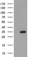 SULT1A1 / Sulfotransferase 1A1 Antibody - HEK293T cells were transfected with the pCMV6-ENTRY control (Left lane) or pCMV6-ENTRY SULT1A1 (Right lane) cDNA for 48 hrs and lysed. Equivalent amounts of cell lysates (5 ug per lane) were separated by SDS-PAGE and immunoblotted with anti-SULT1A1.