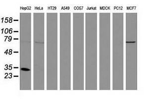 SULT1A1 / Sulfotransferase 1A1 Antibody - Western blot of extracts (35 ug) from 9 different cell lines by using anti-SULT1A1 monoclonal antibody.