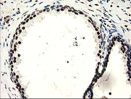 SULT1A1 / Sulfotransferase 1A1 Antibody - IHC of paraffin-embedded Human prostate tissue using anti-SULT1A1 mouse monoclonal antibody.