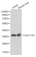 SULT1A1 / Sulfotransferase 1A1 Antibody - Western blot of extracts of various cell lines, using SULT1A1 antibody.