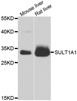 SULT1A1 / Sulfotransferase 1A1 Antibody - Western blot analysis of extracts of various cell lines, using SULT1A1 antibody at 1:1000 dilution. The secondary antibody used was an HRP Goat Anti-Rabbit IgG (H+L) at 1:10000 dilution. Lysates were loaded 25ug per lane and 3% nonfat dry milk in TBST was used for blocking. An ECL Kit was used for detection and the exposure time was 90s.
