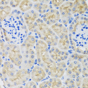 SULT1A1 / Sulfotransferase 1A1 Antibody - Immunohistochemistry of paraffin-embedded mouse kidney using SULT1A1 antibodyat dilution of 1:100 (40x lens).