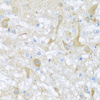 SULT1A1 / Sulfotransferase 1A1 Antibody - Immunohistochemistry of paraffin-embedded rat brain using SULT1A1 antibodyat dilution of 1:100 (40x lens).