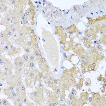 SULT1A1 / Sulfotransferase 1A1 Antibody - Immunohistochemistry of paraffin-embedded human liver injury using SULT1A1 antibodyat dilution of 1:100 (40x lens).
