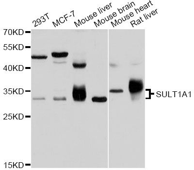 SULT1A1 / Sulfotransferase 1A1 Antibody - Western blot analysis of extracts of various cell lines, using SULT1A1 antibody at 1:1000 dilution. The secondary antibody used was an HRP Goat Anti-Rabbit IgG (H+L) at 1:10000 dilution. Lysates were loaded 25ug per lane and 3% nonfat dry milk in TBST was used for blocking. An ECL Kit was used for detection and the exposure time was 10s.