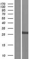 SULT1A1 / Sulfotransferase 1A1 Protein - Western validation with an anti-DDK antibody * L: Control HEK293 lysate R: Over-expression lysate