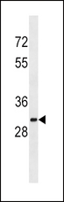 SULT1A2 / Sulfotransferase 1A2 Antibody - SULT1A2 Antibody western blot of K562 cell line lysates (35 ug/lane). The SULT1A2 antibody detected the SULT1A2 protein (arrow).