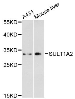 SULT1A2 / Sulfotransferase 1A2 Antibody - Western blot analysis of extracts of various cell lines, using SULT1A2 antibody at 1:3000 dilution. The secondary antibody used was an HRP Goat Anti-Rabbit IgG (H+L) at 1:10000 dilution. Lysates were loaded 25ug per lane and 3% nonfat dry milk in TBST was used for blocking. An ECL Kit was used for detection and the exposure time was 180s.