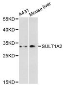 SULT1A2 / Sulfotransferase 1A2 Antibody - Western blot analysis of extracts of various cell lines, using SULT1A2 antibody at 1:3000 dilution. The secondary antibody used was an HRP Goat Anti-Rabbit IgG (H+L) at 1:10000 dilution. Lysates were loaded 25ug per lane and 3% nonfat dry milk in TBST was used for blocking. An ECL Kit was used for detection and the exposure time was 180s.
