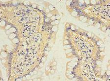 SULT1B1 / Sulfotransferase 1B1 Antibody - Immunohistochemistry of paraffin-embedded human small intestine tissue using antibody at 1:100 dilution.  This image was taken for the unconjugated form of this product. Other forms have not been tested.