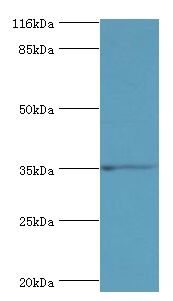 SULT1B1 / Sulfotransferase 1B1 Antibody - Western blot. All lanes: Clathrin heavy chain 2 antibody at 24 ug/ml+mouse small intestine tissue. Secondary antibody: goat polyclonal to rabbit at 1:10000 dilution. Predicted band size: 35 kDa. Observed band size: 35 kDa.  This image was taken for the unconjugated form of this product. Other forms have not been tested.