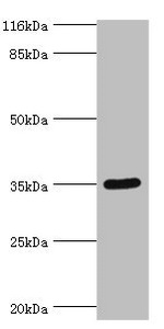 SULT1B1 / Sulfotransferase 1B1 Antibody - Western blot All lanes: Clathrin heavy chain 2 antibody at 24µg/ml + Mouse small intestine tissue Secondary Goat polyclonal to rabbit IgG at 1/10000 dilution Predicted band size: 35 kDa Observed band size: 35 kDa