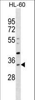 SULT1B1 / Sulfotransferase 1B1 Antibody - SULT1B1 Antibody western blot of HL-60 cell line lysates (35 ug/lane). The SULT1B1 antibody detected the SULT1B1 protein (arrow).
