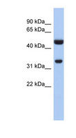 SULT1B1 / Sulfotransferase 1B1 Antibody - SULT1B1 antibody Western blot of Fetal Intestine lysate. This image was taken for the unconjugated form of this product. Other forms have not been tested.