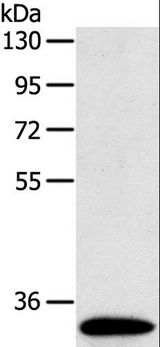 SULT1B1 / Sulfotransferase 1B1 Antibody - Western blot analysis of Human fetal intestines tissue, using SULT1B1 Polyclonal Antibody at dilution of 1:800.