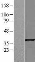 SULT1B1 / Sulfotransferase 1B1 Protein - Western validation with an anti-DDK antibody * L: Control HEK293 lysate R: Over-expression lysate