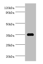 SULT1C2 / Sulfotransferase 1C2 Antibody - Western blot All lanes: SULT1C2 antibody at 5µg/ml + Hela whole cell lysate Secondary Goat polyclonal to rabbit IgG at 1/10000 dilution Predicted band size: 35, 36 kDa Observed band size: 35 kDa