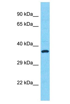 SULT1C2 / Sulfotransferase 1C2 Antibody - SULT1C2 antibody Western Blot of HT1080. Antibody dilution: 1 ug/ml.  This image was taken for the unconjugated form of this product. Other forms have not been tested.