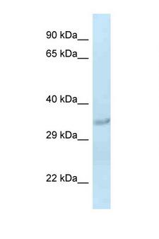 SULT1C2 / Sulfotransferase 1C2 Antibody - SULT1C2 antibody Western blot of Rat Liver lysate. Antibody concentration 1 ug/ml.  This image was taken for the unconjugated form of this product. Other forms have not been tested.