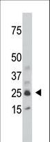 SULT1C2 / Sulfotransferase 1C2 Antibody - The anti-SULT1C1 antibody is used in Western blot to detect SULT1C1 in mouse kidney tissue lysate.