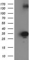 SULT1C2 / Sulfotransferase 1C2 Antibody - HEK293T cells were transfected with the pCMV6-ENTRY control (Left lane) or pCMV6-ENTRY SULT1C2 (Right lane) cDNA for 48 hrs and lysed. Equivalent amounts of cell lysates (5 ug per lane) were separated by SDS-PAGE and immunoblotted with anti-SULT1C2.