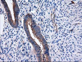 SULT1C2 / Sulfotransferase 1C2 Antibody - IHC of paraffin-embedded Human endometrium tissue using anti-SULT1C2 mouse monoclonal antibody. (Heat-induced epitope retrieval by 10mM citric buffer, pH6.0, 100C for 10min).