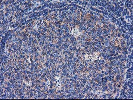 SULT1C2 / Sulfotransferase 1C2 Antibody - IHC of paraffin-embedded Human lymph node tissue using anti-SULT1C2 mouse monoclonal antibody. (Heat-induced epitope retrieval by 10mM citric buffer, pH6.0, 100C for 10min).