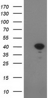 SULT1C2 / Sulfotransferase 1C2 Antibody - HEK293T cells were transfected with the pCMV6-ENTRY control (Left lane) or pCMV6-ENTRY SULT1C2 (Right lane) cDNA for 48 hrs and lysed. Equivalent amounts of cell lysates (5 ug per lane) were separated by SDS-PAGE and immunoblotted with anti-SULT1C2.