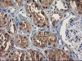 SULT1C2 / Sulfotransferase 1C2 Antibody - IHC of paraffin-embedded Human Kidney tissue using anti-SULT1C2 mouse monoclonal antibody. (Heat-induced epitope retrieval by 10mM citric buffer, pH6.0, 100C for 10min).