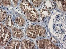 SULT1C2 / Sulfotransferase 1C2 Antibody - IHC of paraffin-embedded Human Kidney tissue using anti-SULT1C2 mouse monoclonal antibody. (Heat-induced epitope retrieval by 10mM citric buffer, pH6.0, 100C for 10min).