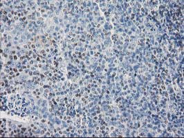 SULT1C2 / Sulfotransferase 1C2 Antibody - IHC of paraffin-embedded Human lymph node tissue using anti-SULT1C2 mouse monoclonal antibody. (Heat-induced epitope retrieval by 10mM citric buffer, pH6.0, 100C for 10min).