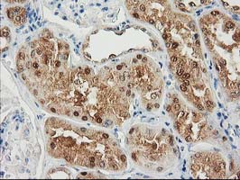 SULT1C2 / Sulfotransferase 1C2 Antibody - IHC of paraffin-embedded Human Kidney tissue using anti-SULT1C2 mouse monoclonal antibody.