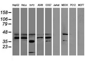 SULT1C2 / Sulfotransferase 1C2 Antibody - Western blot of extracts (35 ug) from 9 different cell lines by using anti-SULT1C2 monoclonal antibody.