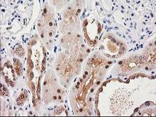 SULT1C2 / Sulfotransferase 1C2 Antibody - IHC of paraffin-embedded Human Kidney tissue using anti-SULT1C2 mouse monoclonal antibody.