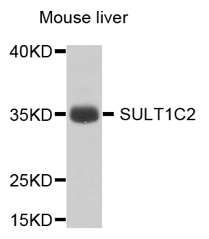 SULT1C2 / Sulfotransferase 1C2 Antibody - Western blot analysis of extract of various cells.