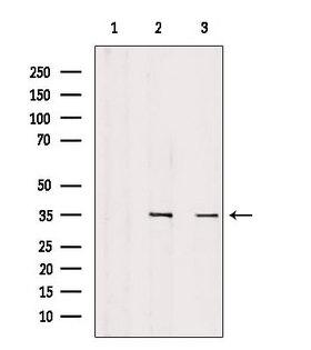 SULT1C2 / Sulfotransferase 1C2 Antibody - Western blot analysis of extracts of various samples using SULT1C2 antibody. Lane 1: rat brain treated with blocking peptide. Lane 2: rat brain; Lane 3: B16F10;