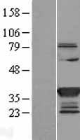 SULT1C2 / Sulfotransferase 1C2 Protein - Western validation with an anti-DDK antibody * L: Control HEK293 lysate R: Over-expression lysate
