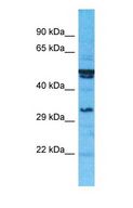 SULT1C3 / Sulfotransferase 1C3 Antibody - Western blot of SULT1C3 Antibody with human 721_B Whole Cell lysate.  This image was taken for the unconjugated form of this product. Other forms have not been tested.