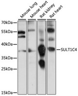 SULT1C4 / Sulfotransferase 1C4 Antibody - Western blot analysis of extracts of various cell lines, using SULT1C4 antibody at 1:1000 dilution. The secondary antibody used was an HRP Goat Anti-Rabbit IgG (H+L) at 1:10000 dilution. Lysates were loaded 25ug per lane and 3% nonfat dry milk in TBST was used for blocking. An ECL Kit was used for detection and the exposure time was 2s.