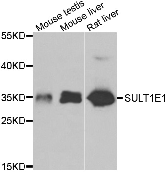 SULT1E1 / Sulfotransferase 1E1 Antibody - Western blot analysis of extracts of various cell lines.