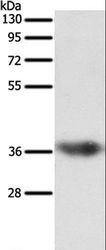 SULT1E1 / Sulfotransferase 1E1 Antibody - Western blot analysis of Human liver cancer tissue, using SULT1E1 Polyclonal Antibody at dilution of 1:500.