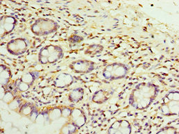 SULT1E1 / Sulfotransferase 1E1 Antibody - Immunohistochemistry of paraffin-embedded human small intestine tissue at dilution 1:100