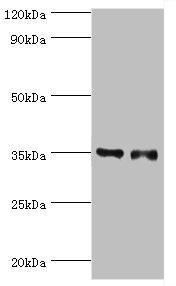 SULT1E1 / Sulfotransferase 1E1 Antibody - All  Lanes: Estrogen s ulfotransferase antibody at 7ug/ml Lane 1:mouse lung tissue Lane 2:mouse liver tissue Secondary Goat polyclonal to rabbit at 1/10000 dilution Predicted band size: 35,30 kDa Observed band size: 35 kDa